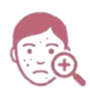 Acne Treatment - Edna´s Super Salon