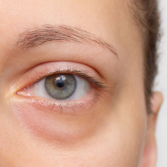 Skin Care Treatment - Edna´s Super Salon