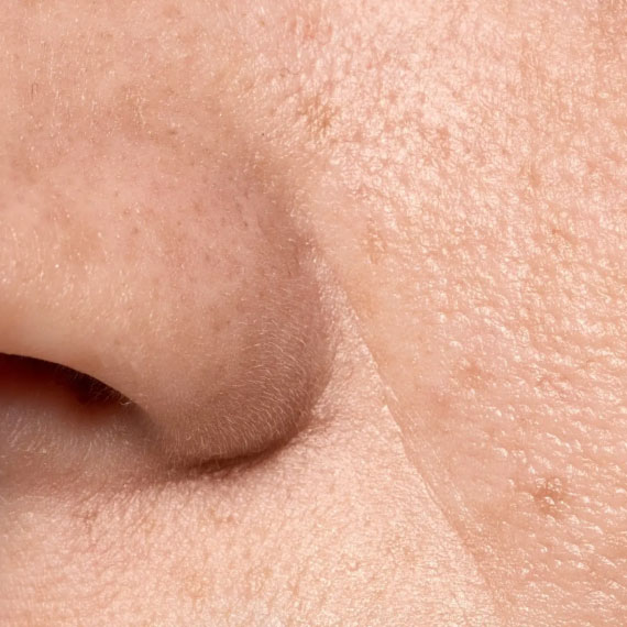 Skin Care Treatment - Edna´s Super Salon