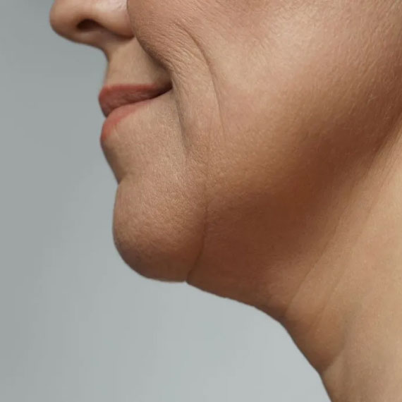 Skin Care Treatment - Edna´s Super Salon